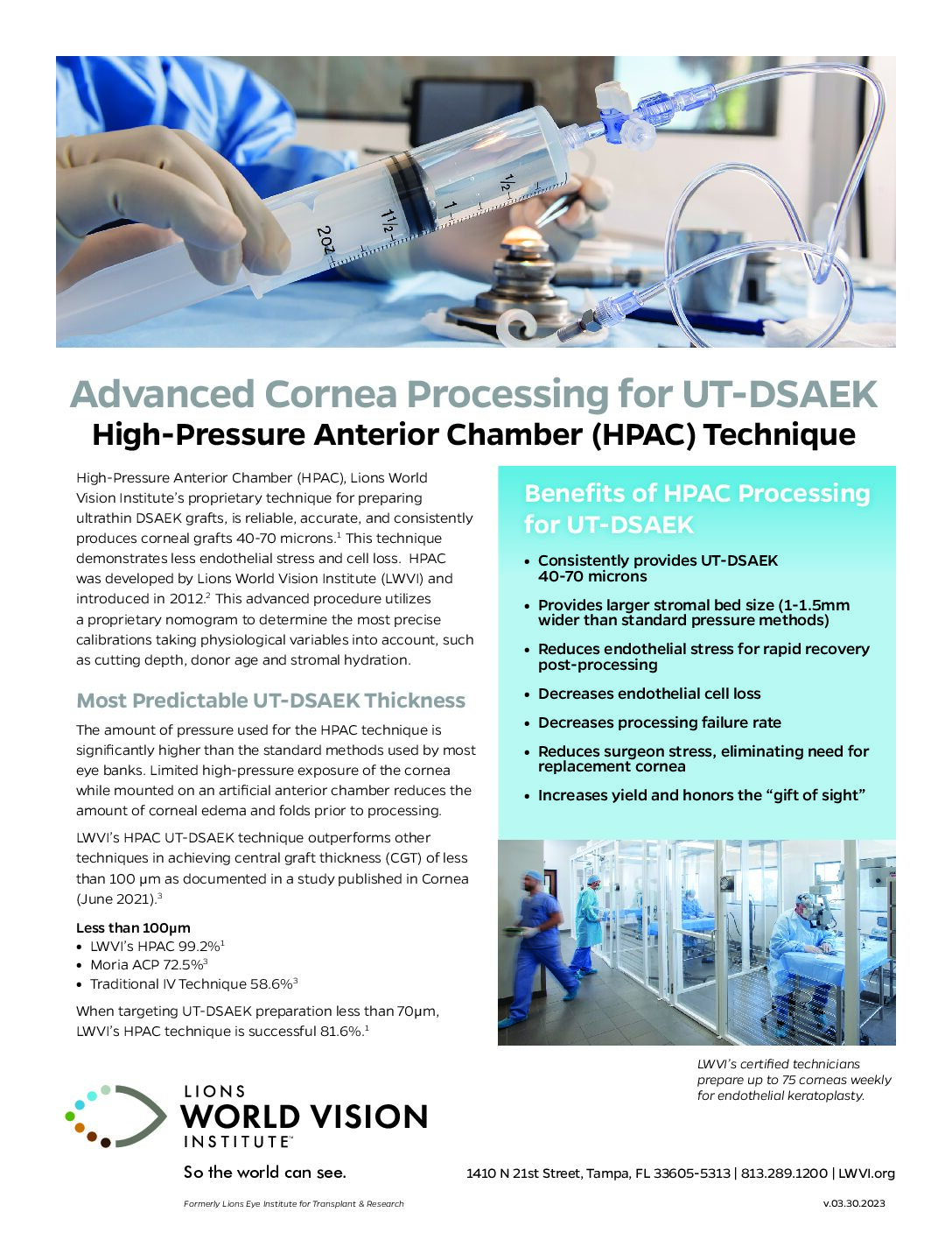 Click to open the Advanced Cornea Processing for UT-DSAEK file