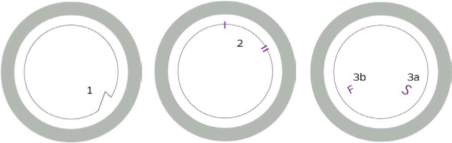 DMEK Orientation Marking Options