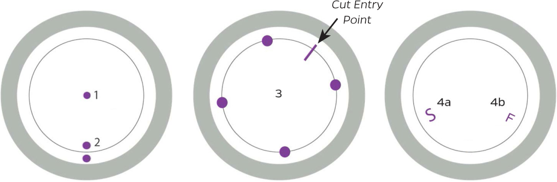 DSAEK Orientation Markings